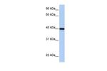 RDH11 Polyclonal Antibody