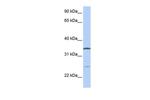OCIAD1 Polyclonal Antibody