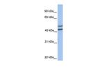 GALT Polyclonal Antibody