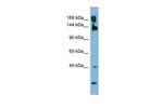 WNK3 Polyclonal Antibody