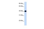 LIAS Polyclonal Antibody