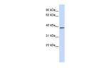 QPCT Polyclonal Antibody