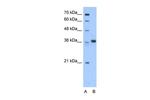 AASDHPPT Polyclonal Antibody