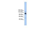 POLR3B Polyclonal Antibody