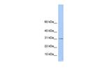 ECHDC1 Polyclonal Antibody