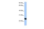 CSGlcAT Polyclonal Antibody