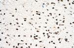 PGS1 Polyclonal Antibody