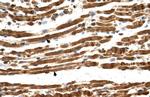 NAA16 Antibody in Immunohistochemistry (IHC)