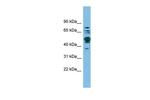 SHMT1 Polyclonal Antibody