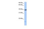 HS3ST5 Polyclonal Antibody