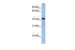 GMPPA Polyclonal Antibody