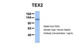 TEX2 Antibody in Western Blot (WB)