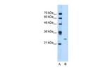 TMEM126B Polyclonal Antibody