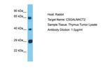 CSGALNACT2 Polyclonal Antibody