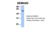 SEMA6D Antibody in Western Blot (WB)