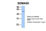 SEMA6D Antibody in Western Blot (WB)