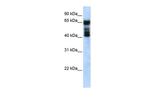UGT2B4 Polyclonal Antibody