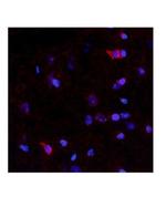NTN4 Polyclonal Antibody