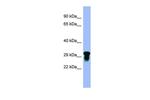 VISTA Polyclonal Antibody