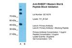 RHBDF1 Polyclonal Antibody