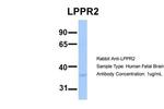 LPPR2 Polyclonal Antibody