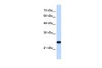 TMEM109 Antibody in Western Blot (WB)