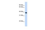 ACBD4 Polyclonal Antibody