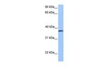 UBA5 Polyclonal Antibody