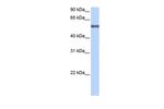 LRRC8E Antibody in Western Blot (WB)