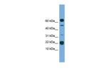 TMEM107 Polyclonal Antibody