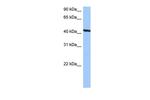 TMEM118 Antibody in Western Blot (WB)