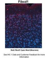 FIBCD1 Polyclonal Antibody