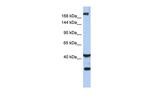 DISP1 Polyclonal Antibody