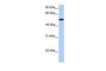 GALNT13 Polyclonal Antibody