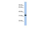 CMG2 Polyclonal Antibody