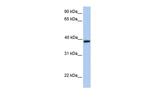 Aquaporin 10 Polyclonal Antibody