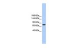TMC2 Polyclonal Antibody