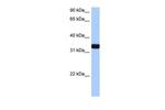 GIMAP1 Polyclonal Antibody