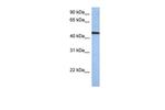 ZNF766 Antibody in Western Blot (WB)