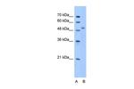 ZNF763 Polyclonal Antibody