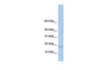ZNHIT3 Polyclonal Antibody