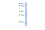 SPRY2 Polyclonal Antibody