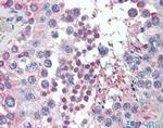 MED4 Antibody in Immunohistochemistry (IHC)