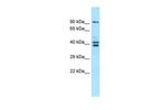 L3MBTL3 Polyclonal Antibody
