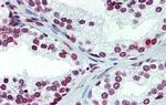 ARID5A Antibody in Immunohistochemistry (IHC)