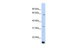 ARID5A Antibody in Western Blot (WB)