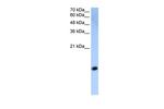 HIST2H2AC Polyclonal Antibody