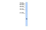 HIST2H2AA3 Polyclonal Antibody