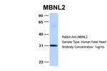MBNL2 Antibody in Western Blot (WB)