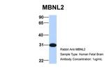 MBNL2 Antibody in Western Blot (WB)